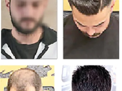 Anaokulu tarayanların sonu - fotoğraf 1