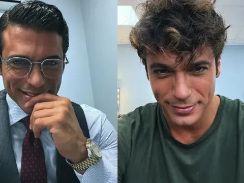Can Yaman yeni imajıyla şaşırttı. Seneler sonra bambaşka biri oldu - fotoğraf 1
