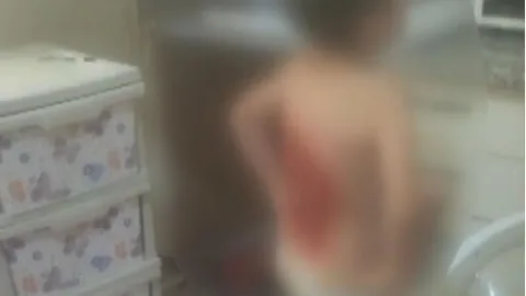 Akran zulmü! Çocuğun sırtını kolonya ile yaktılar