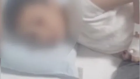 Arkadaşları kolonya dökülüp ateşe verdi. 12 yaşındaki çocuk 1 ay tedavi gördü