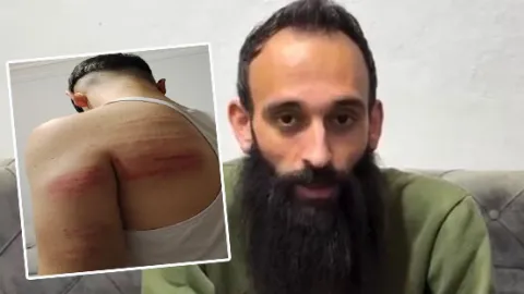 Berber şiddeti! 2 çırağını demir sopayla dövdü