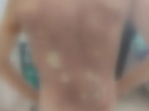 Arnavutköy'de akran vahşeti: Arkadaşları kolonya döküp yaktı, 12 yaşındaki çocuk hastanelik oldu - fotoğraf 3