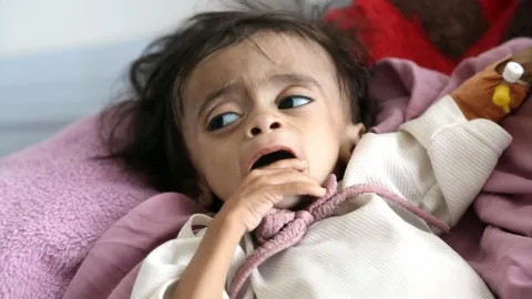 BMden Yemende insani kriz uyarısı