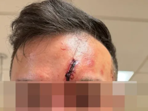 İngiltere'de ev içinde bıçaklı kripto para hırsızlığı: 'Dehşet vericiydi' - fotoğraf 6