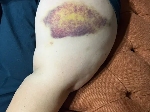 Adana'da ev basıp dehşeti yaşattılar: "Oğluma keserle, eşime zincirle saldırdılar!" - fotoğraf 1