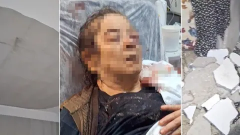 Evinde otururken üzerine tavan çöktü! 75 yaşındaki kadın görme kaybı yaşıyor