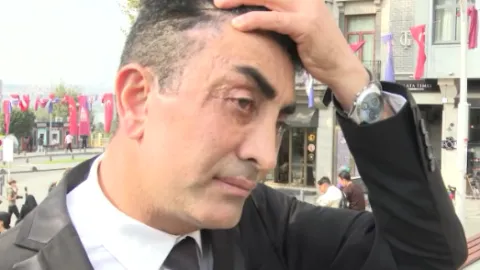 Genç görünme hayali kabusa dönüştü: 4 kez bıçak altına yattı