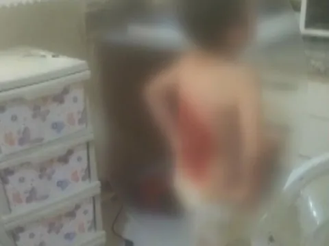 Arnavutköy'de akran vahşeti: Arkadaşları kolonya döküp yaktı, 12 yaşındaki çocuk hastanelik oldu - fotoğraf 4