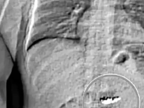 Çaldığı serveti tek hamlede yuttu: Polis çıkarsın diye günlerce başında bekledi - fotoğraf 1