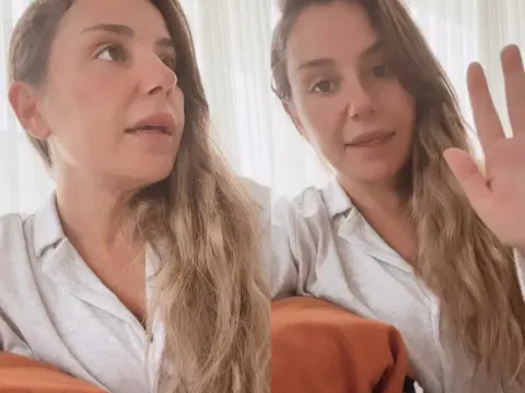 Konserde merdivenden düşmüştü. Merve Özbey'in tedavisi bitti - fotoğraf 1