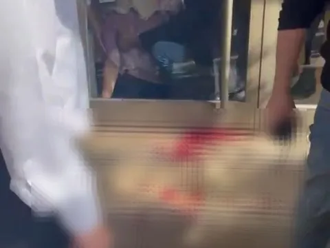 3,5 aylık hamile kadına tahralı saldırı: 2 hafta önce cezaevinden tahliye edilmiş - fotoğraf 2