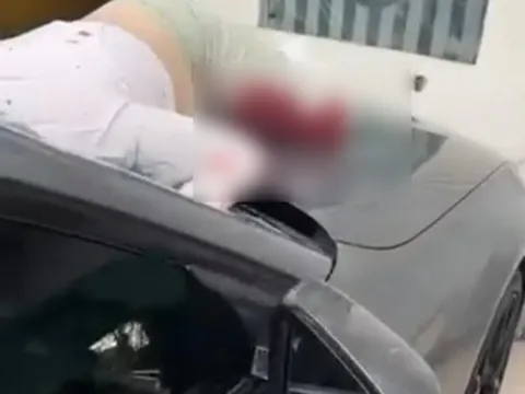Ankara Çankaya'da otelin 6. katından düşen kadın aracın üstüne çakılıp ağır yaralandı - fotoğraf 1