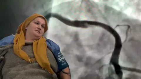Milyonda bir görülen vaka. Öksürürken kalp damarı yırtıldı