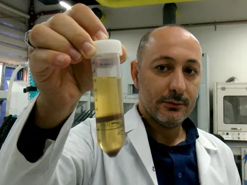 Veganlar için yeni alternatif: Fındıktan bitkisel protein tozu üretilecek - fotoğraf 2