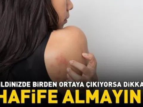 Sonbaharda Saçları Yıpratan 6 Alışkanlık! Fark Etmeden Yapılıyor - fotoğraf 4