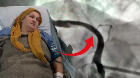 Sadece öksürmek isterken milyonda bir görülen vaka başına geldi!