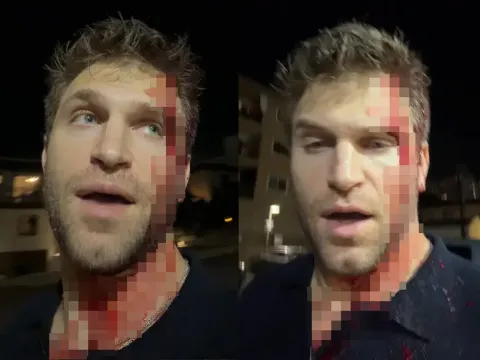 Pretty Little Liars yıldızı Keegan Allen saldırıya uğradı. Kanlar içinde olayı anlattı - fotoğraf 1