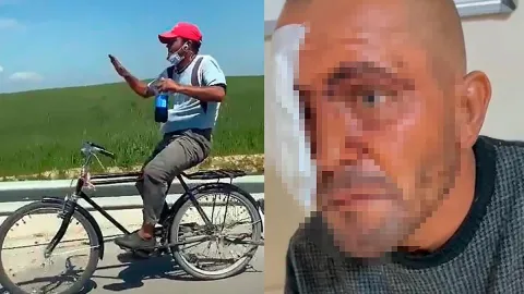 Zihinsel engelli sosyal medya fenomeni darbedildi